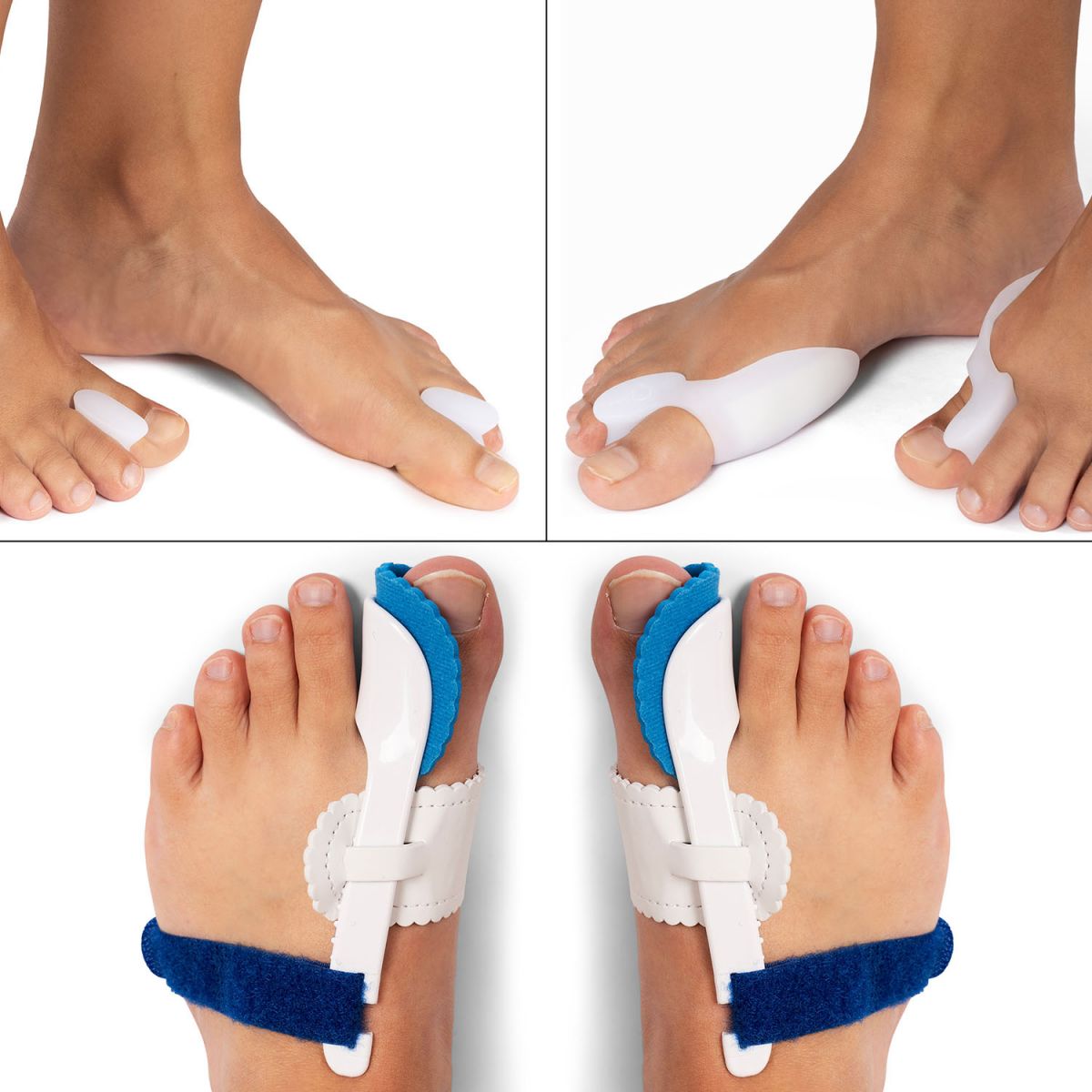 Hallux Valgus pakket kopen Podobrace