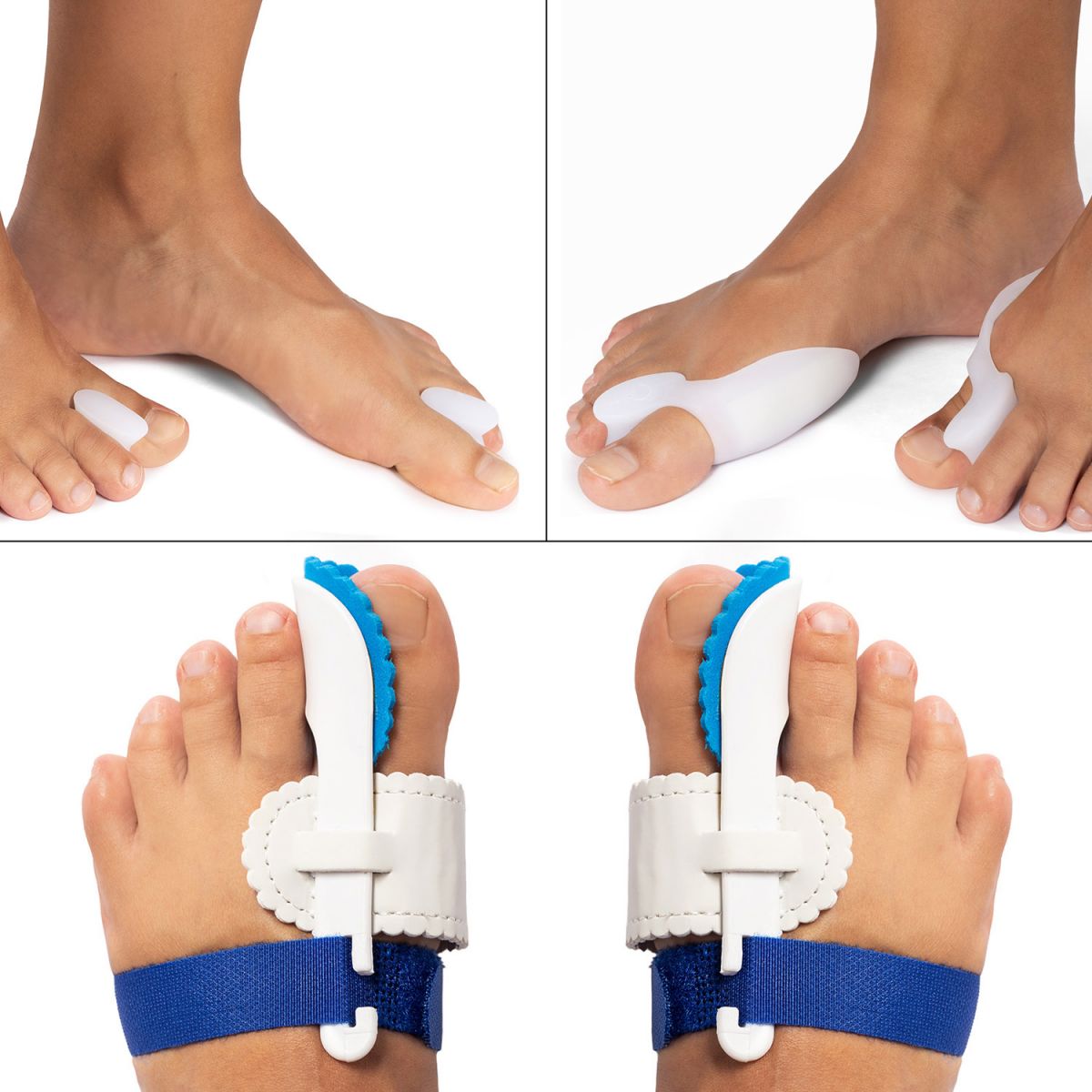 Kruiden Acrobatiek Goed doen Hallux Valgus pakket kopen? | Podobrace.nl