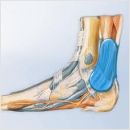 Novamed / Morsa Achiloberg achillespees brace